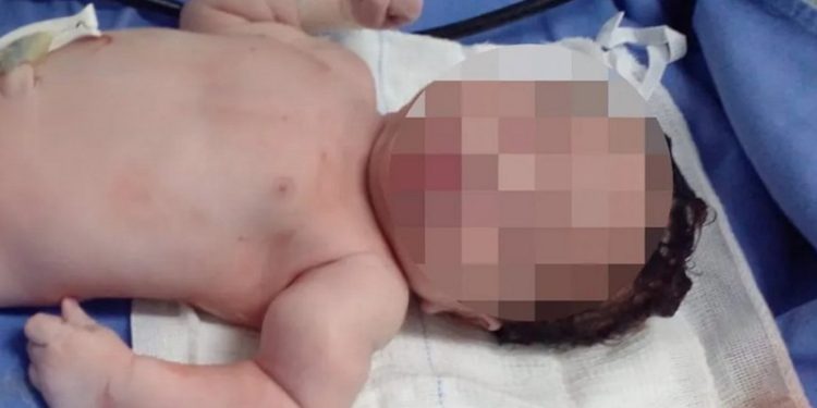 Bebê tem braço quebrado durante parto e país suspeitam de erro médico