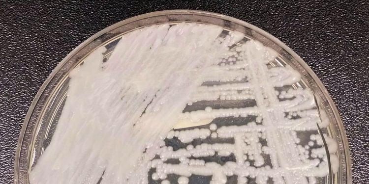 Fiocruz e Pasteur vão pesquisar sobre danos dos fungos no ser humano