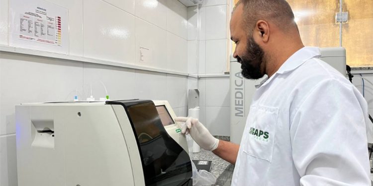 Laboratório do Hospital da Mulher realiza exames para o diagnóstico da anemia falciforme
