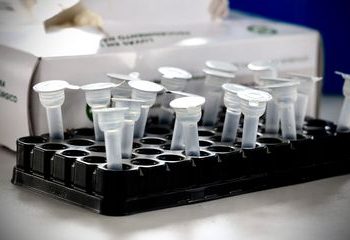 Anvisa deixa de exigir teste de covid-19 para entrada no país