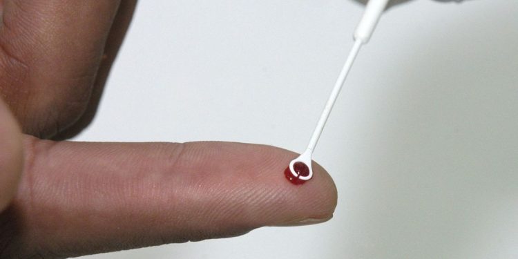 Medicamento injetável é nova opção de prevenção contra HIV no Brasil