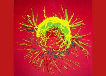 Número de casos de câncer entre jovens cresce 79% em 30 anos