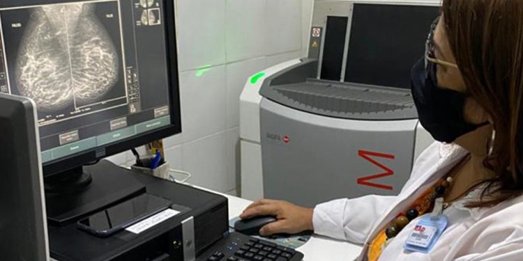 Em um ano, Prefeitura de Feira registra aumento de quase 20% de mamografias realizadas