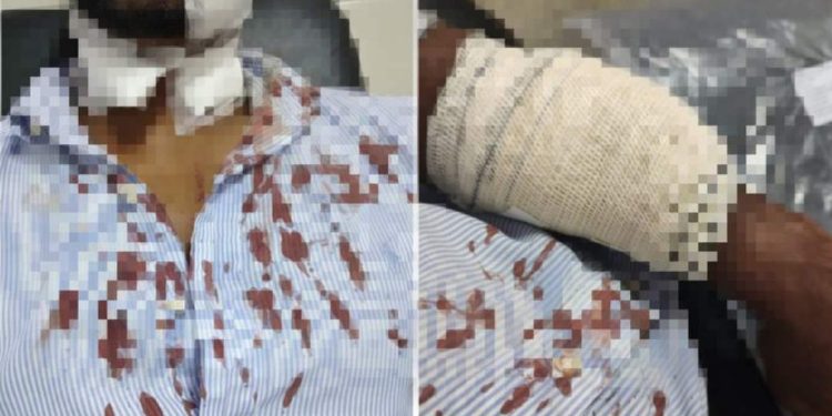 Taxista é esfaqueado em Salvador por norte- americano