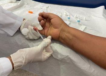 Testagem para diagnóstico de HIV é promovida na UBS Queimadinha