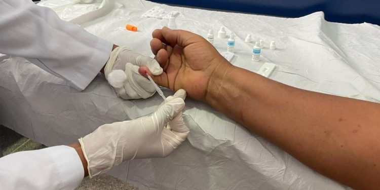 Testagem para diagnóstico de HIV é promovida na UBS Queimadinha