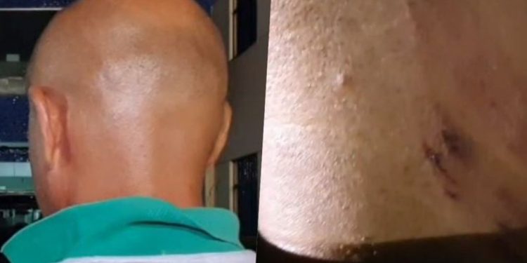 Empresário de Feira é sequestrado, torturado e sofre prejuízo de cerca de R$ 80 mil