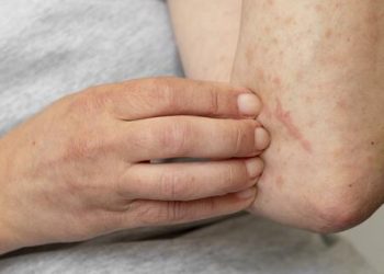 Mais de 54% dos brasileiros entre 16 e 25 anos estão infectados com HPV