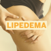 Lipedema: mais de 10 milhões de brasileiras podem ter a doença e não sabem