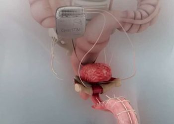 Com ‘viagra eletrônico’, brasileiro quer revolucionar tratamento de disfunção