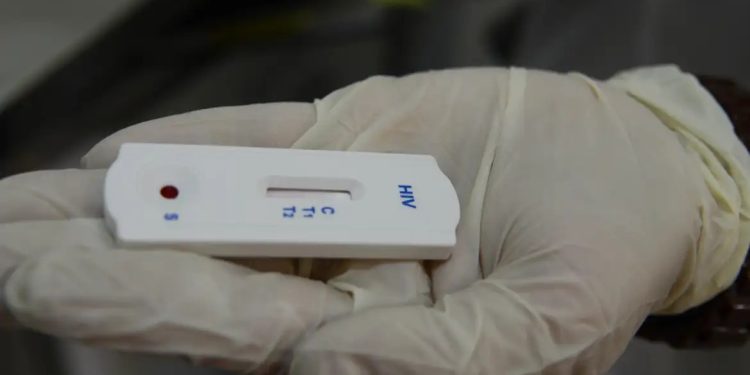 Farmácias autorizadas a realizar testes de ISTs devem ficar atentas à nota técnica do Ministério da Saúde