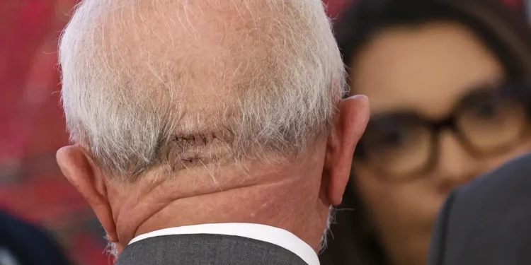 Lula faz exames em Brasília e apresenta quadro estável