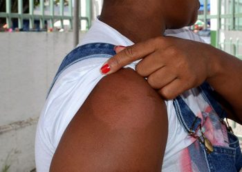 Janeiro Roxo: Hanseníase pode causar manchas e perda de sensibilidade