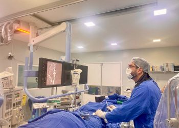 Santa Casa de Feira de Santana realiza primeira embolização de aneurisma cerebral pelo SUS