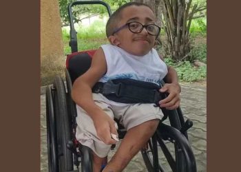 Morre Davi Lucca, adolescente com “ossos de vidro”, aos 15 anos em Feira de Santana