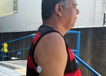 Feira de Santana inicia uso experimental de sensores de glicemia em pacientes do SUS