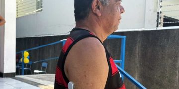 Feira de Santana inicia uso experimental de sensores de glicemia em pacientes do SUS