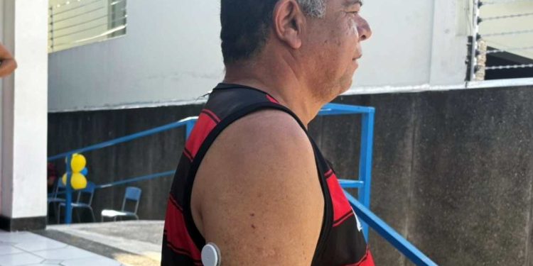 Feira de Santana inicia uso experimental de sensores de glicemia em pacientes do SUS
