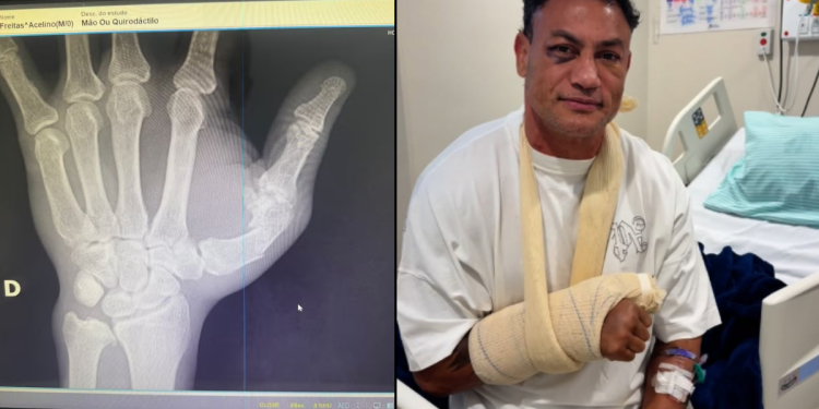 Popó recebe alta após cirurgia e tranquiliza fãs: “Deu tudo certo, estamos bem”