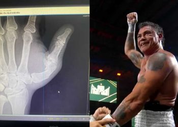 Popó passa por cirurgia em Salvador após lesão na mão durante briga no Spaten Fight Night