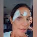 Ivete Sangalo recebe alta após desmaio, brinca com machucados no rosto e revela diagnóstico médico